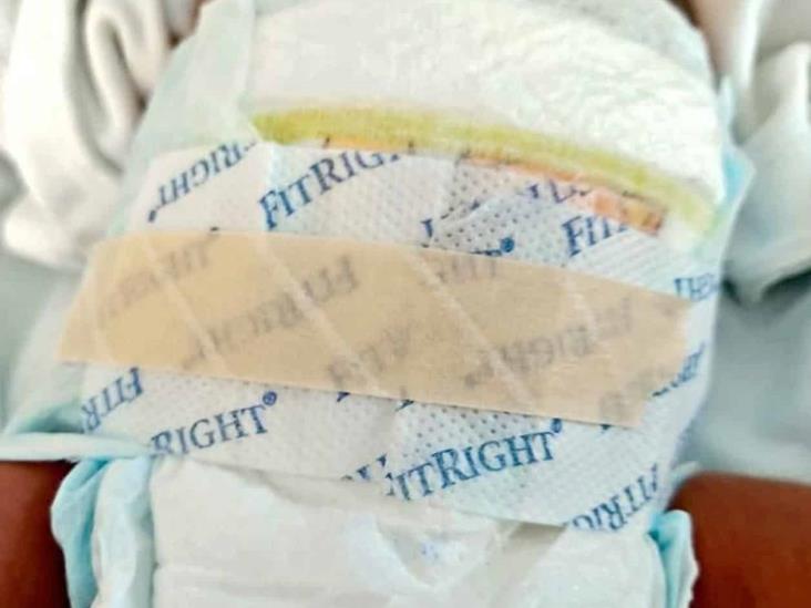 Acusan falta de pañales para bebés en el ISSSTE Acusan falta de pañales para bebés en el ISSSTE
