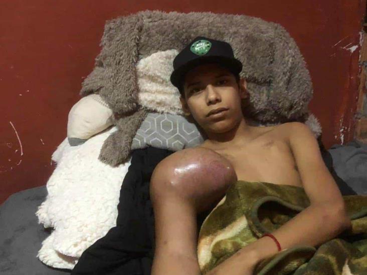 Cáncer lo deja sin el deporte Cáncer lo deja sin el deporte